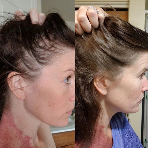 Ser Creștere Păr cu Biotină